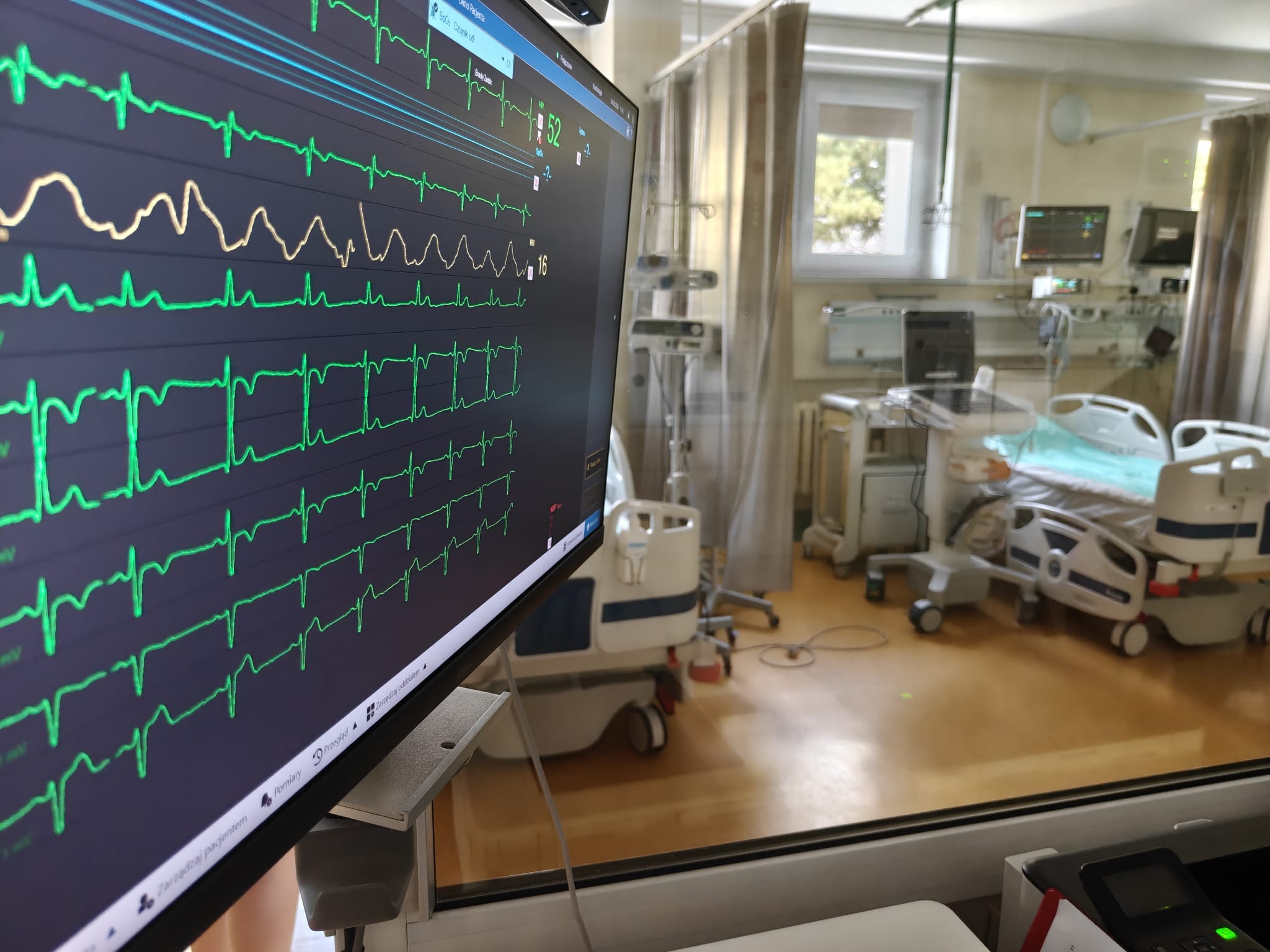 Sala Intensywnego Nadzoru Kardiologicznego Sala Intensywnego Nadzoru Kardiologicznego